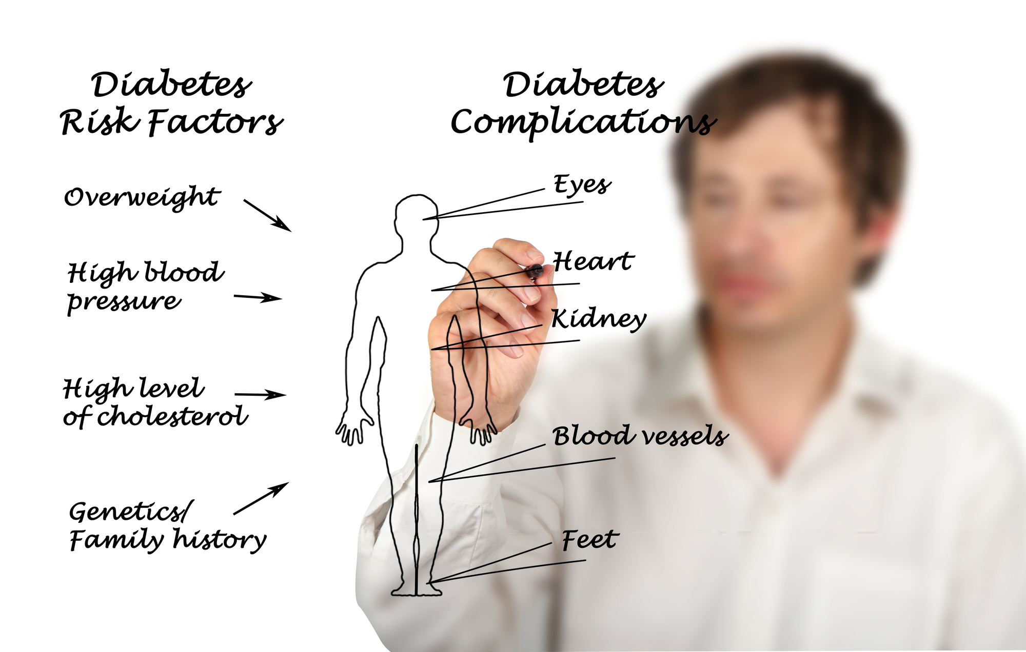 prediabetes risk factors prediabetes risk factors