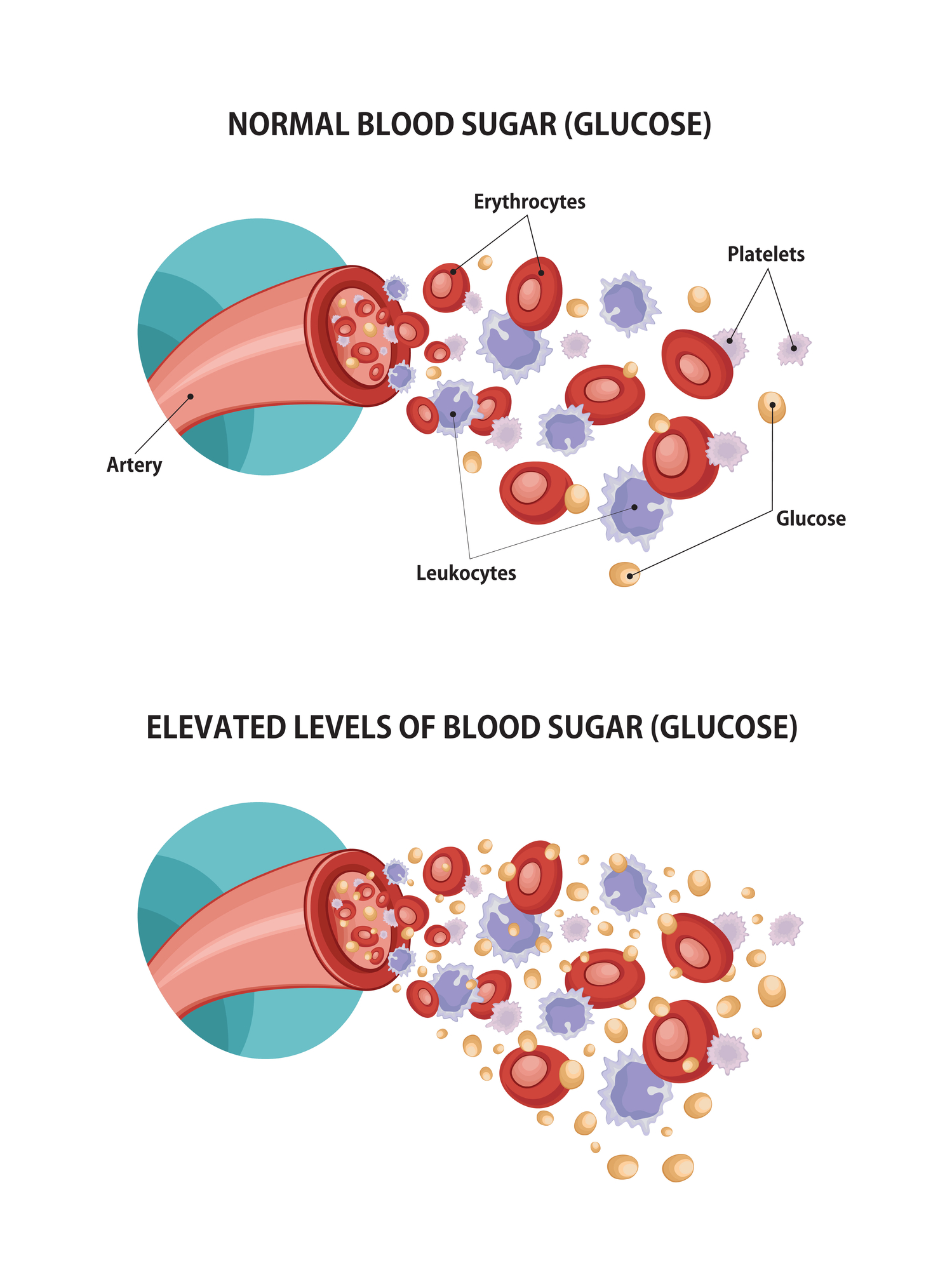 high glucose high glucose