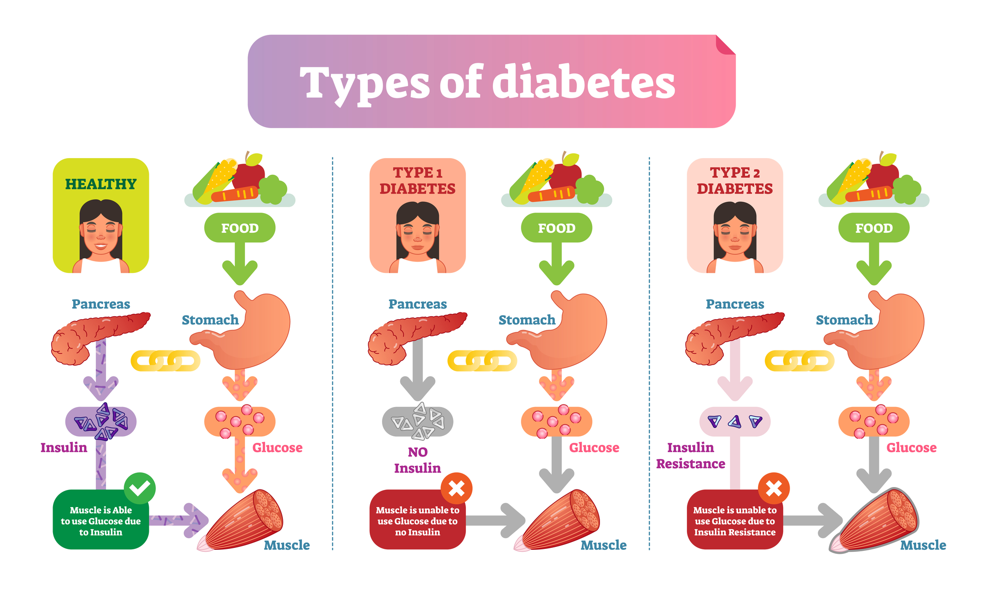 typesofdiabetes